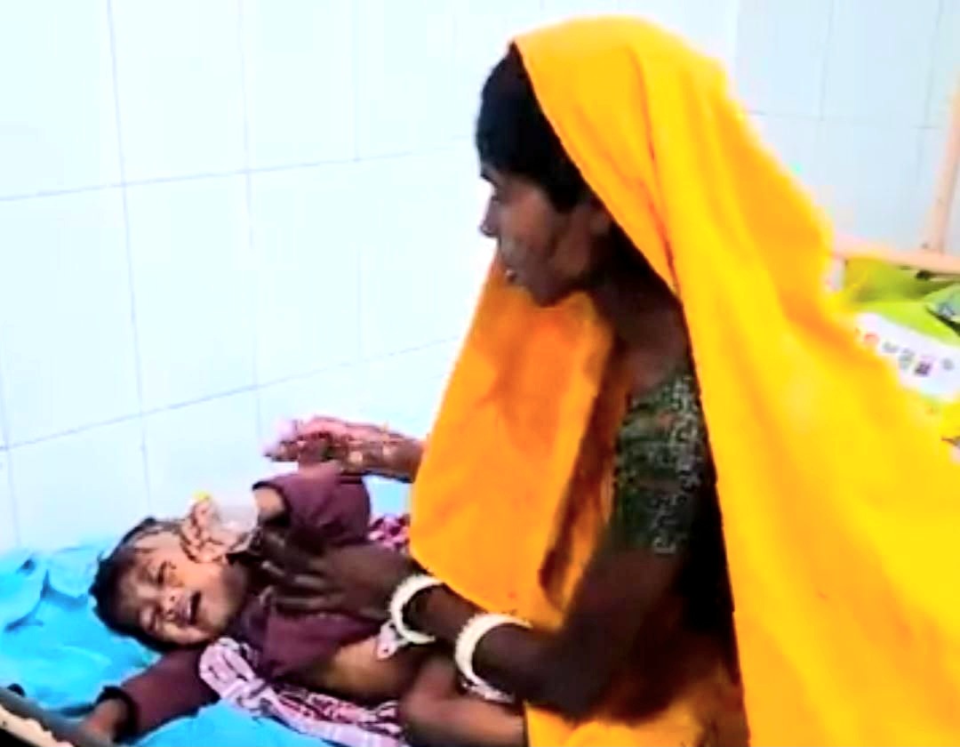 दो साल की मासूम को जबड़े में दबाकर ले जा रहा था कुत्ता,लाठी लेकर भिड़ गई मां