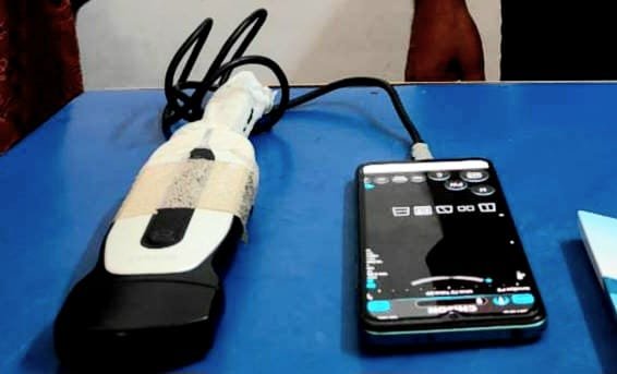 मोबाइल ऐप से 50 हजार में भ्रूण लिंग परीक्षण